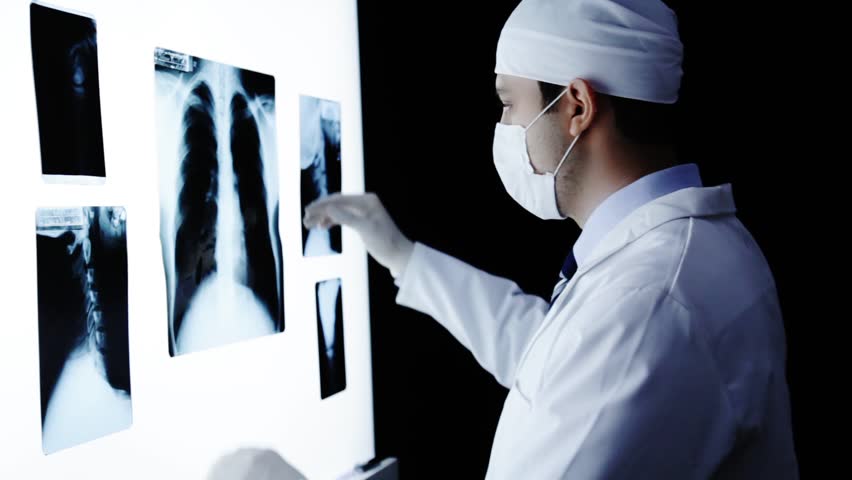 Interventional radiologists in India - Interventional Oncology in Bangalore